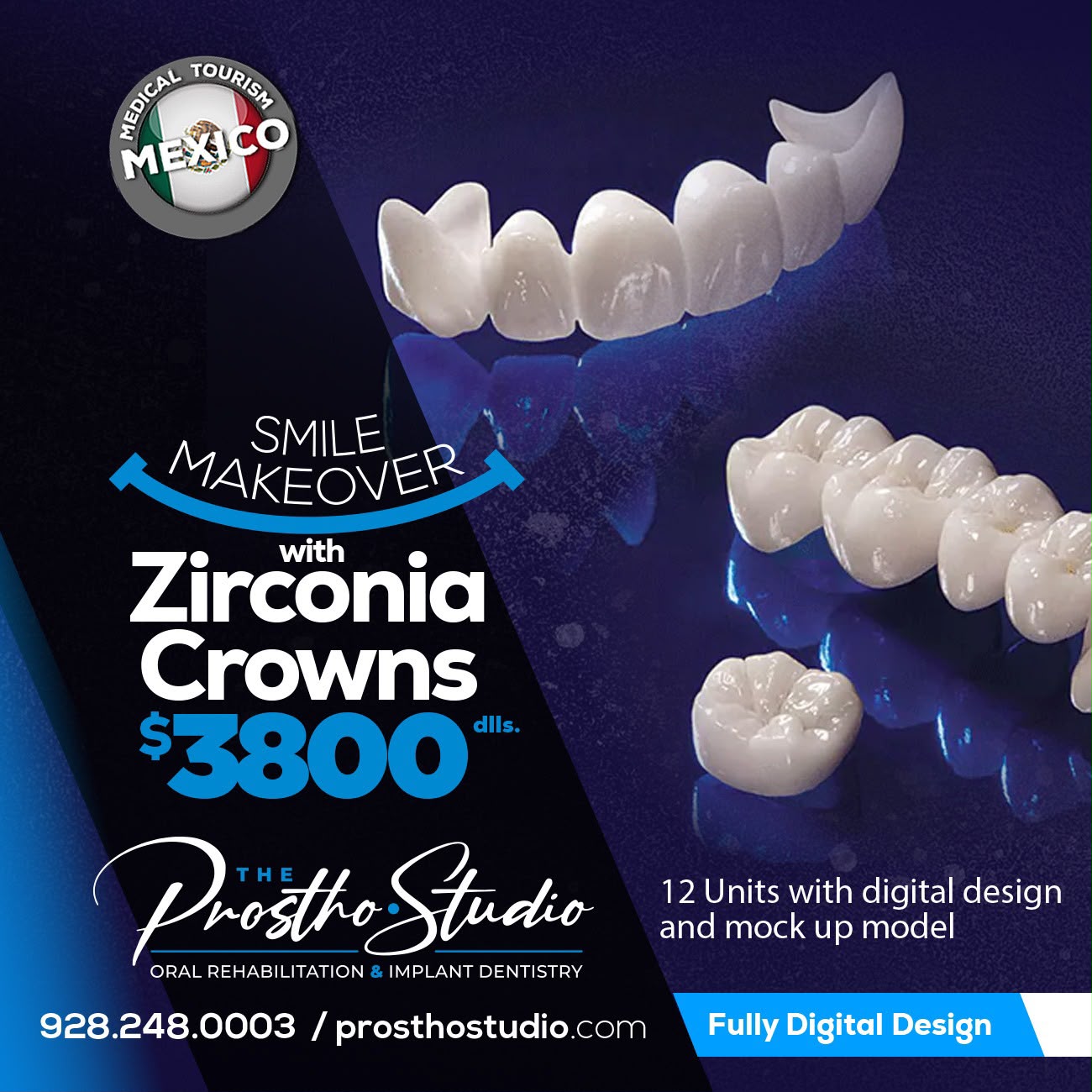 Smile Makeover Zirconia Crowns 