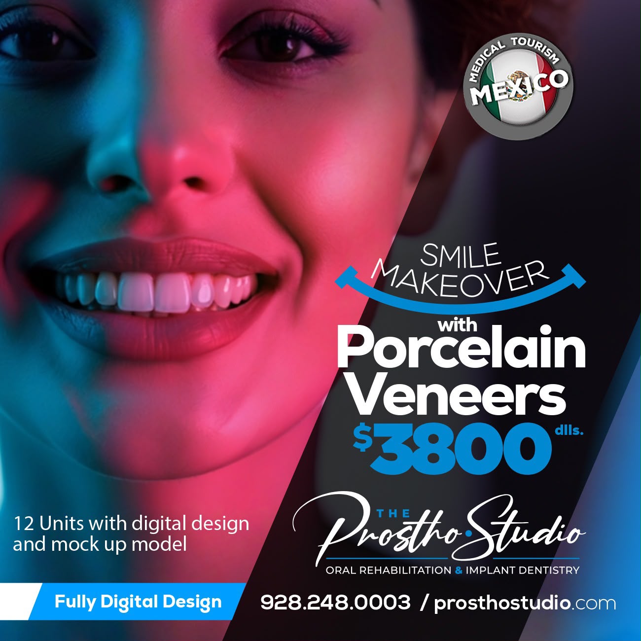 Smile Makeover with Porcelain Veneers 