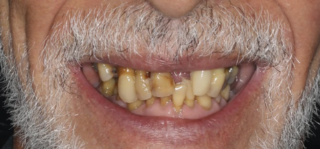 Before