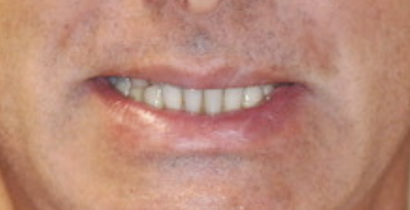 Before