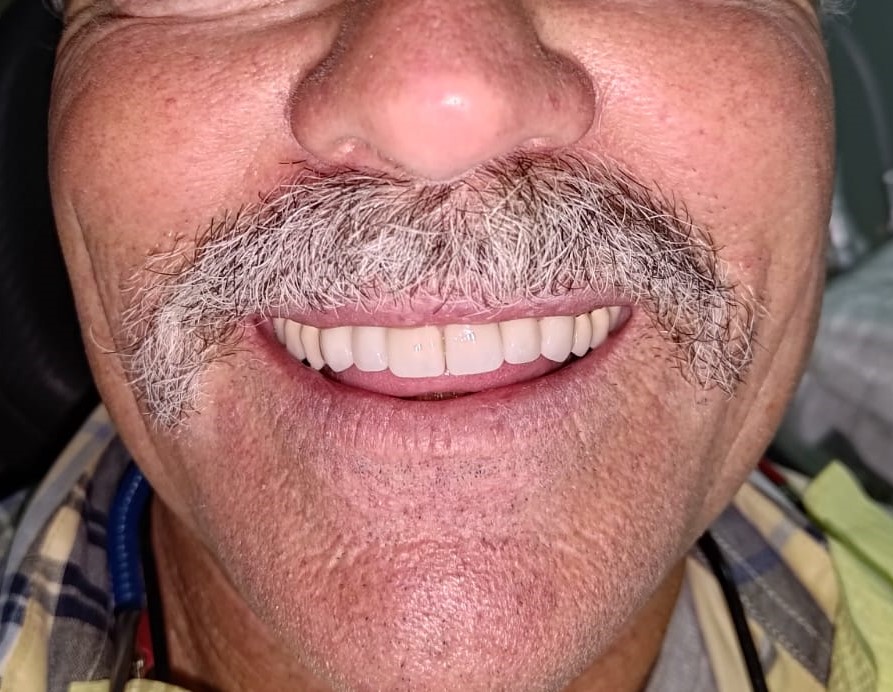 After
