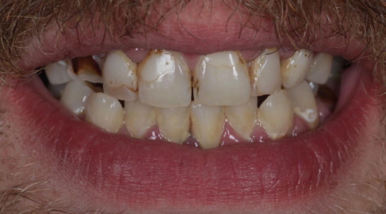 Before