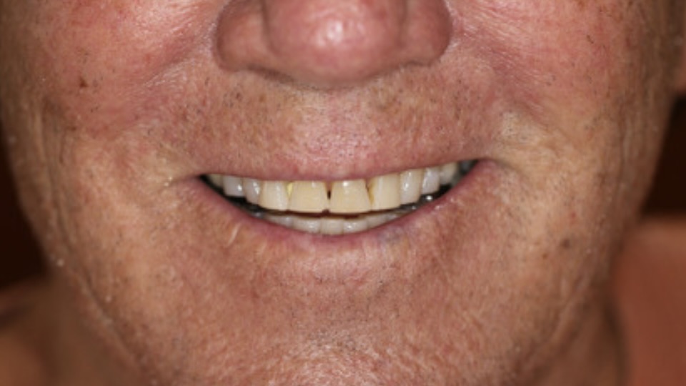 Before
